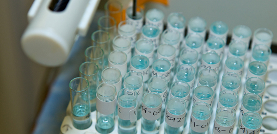 blue vials image